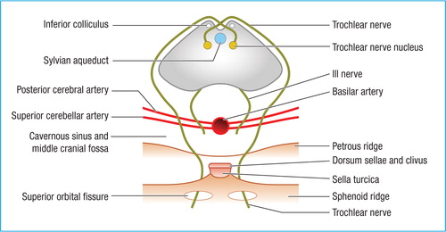 trochlear-nerve