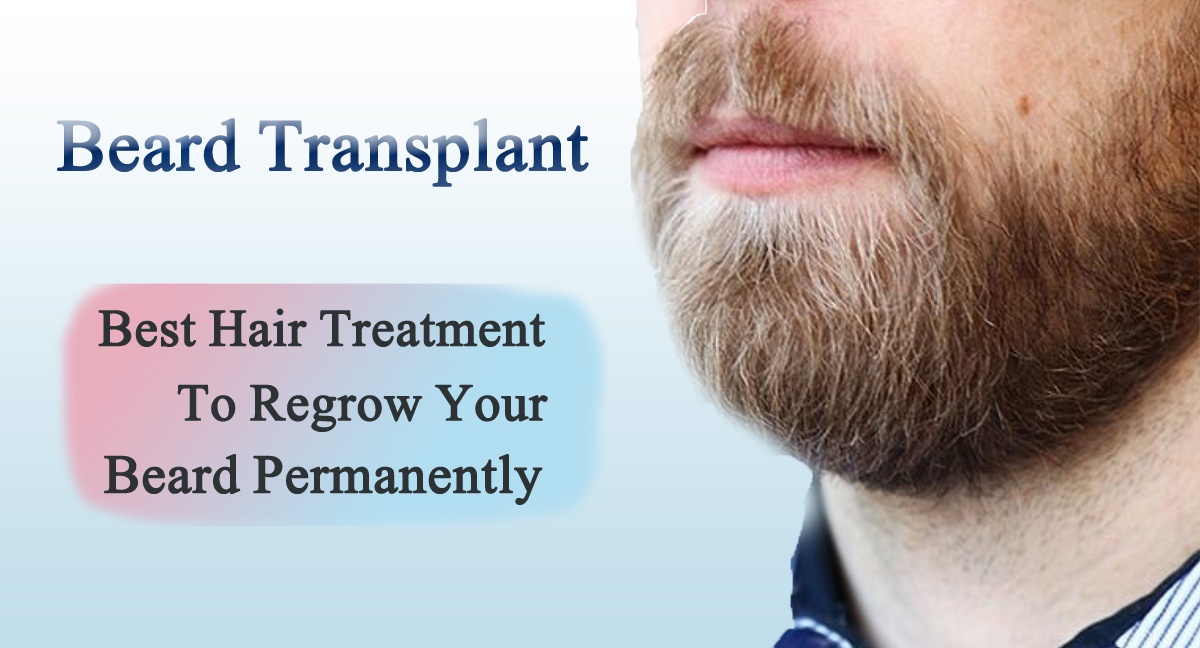 beard transplant- Best hair treatment to regrow your hair permanently