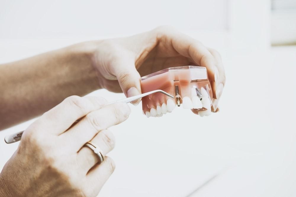 Close up of a dentist showing dental implants on model teeth